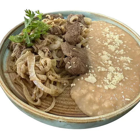 Hígado encebollado 